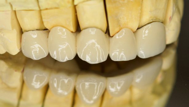 TPS_1-2_17_protetyka_SZEROKOSC_BIOLOGICZNA_PRZYZEBIA_FOT_8