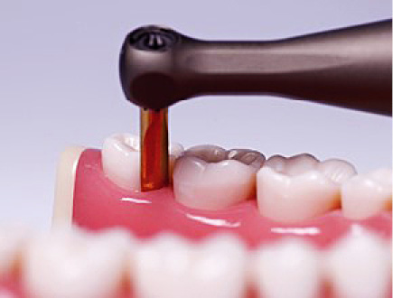 TPS_9_20_stomatologia_zachowawcza_endodoncja_EKSTRAKCJE_ZEBOW_FOT_6