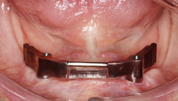 Zastosowanie elementów precyzyjnych