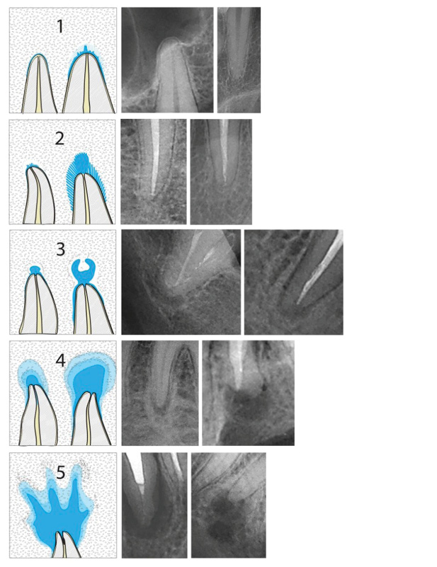 Radiologiczne monitorowanie wyników