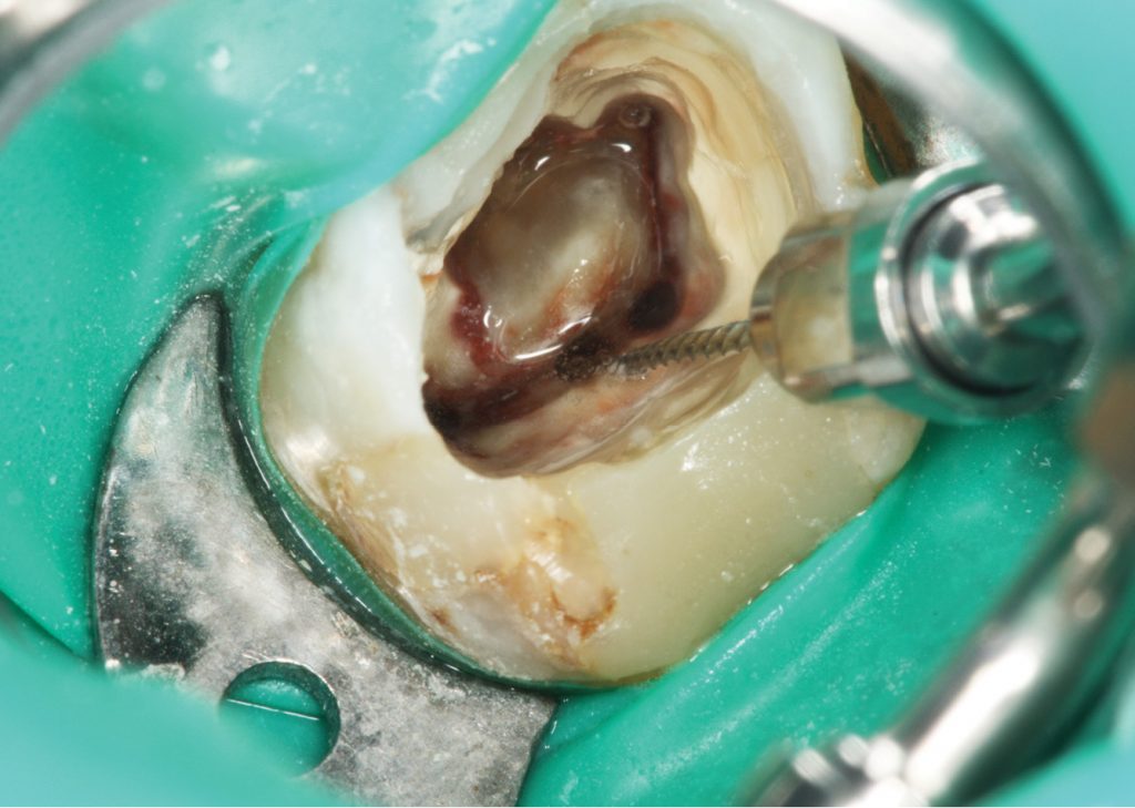 ultradźwiękowy megatrick