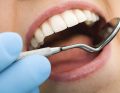 Zmiany patologiczne w jamie ustnej