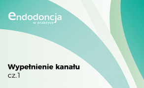 wypełnienie kanału cz. I