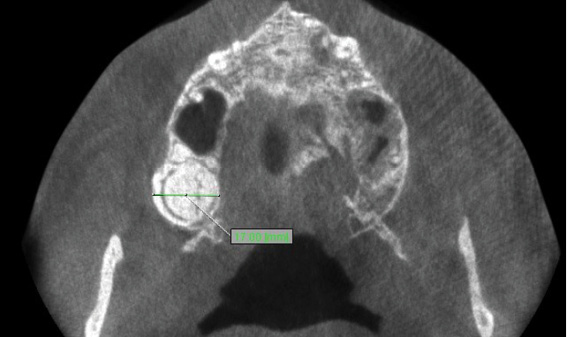 TPS_12_16_temat_numeru_ZEBIAK_ZLOZONY_FOT_2