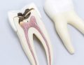 sprzęt endodontyczny
