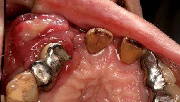 czujność onkologiczna