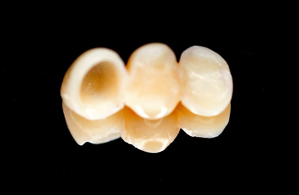 TPS_10_16_protetyka_MOST_KOMPOZYTOWY_WZMOCNIONY_WLOKNEM_SZKLANYM_FOT_9