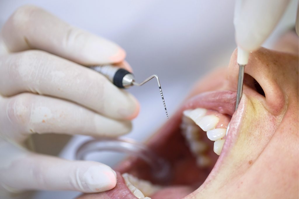 Jak rozpoznać periodontopatię