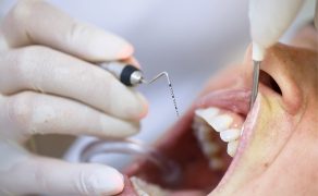 Jak rozpoznać periodontopatię