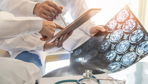 Pacjent z udarem mózgu