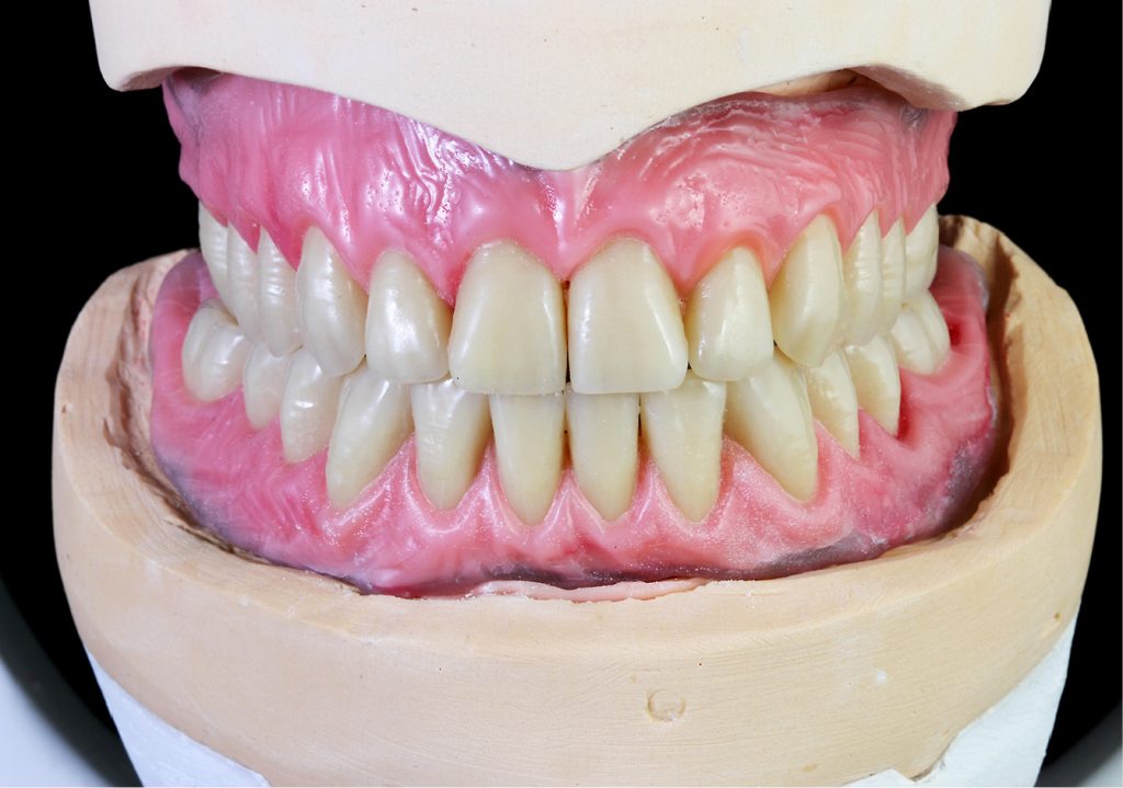 TPS_9_16_protetyka_PROTEZY_FUNKCJA_ESTETYKA_HIGIENA_FOT_3_B