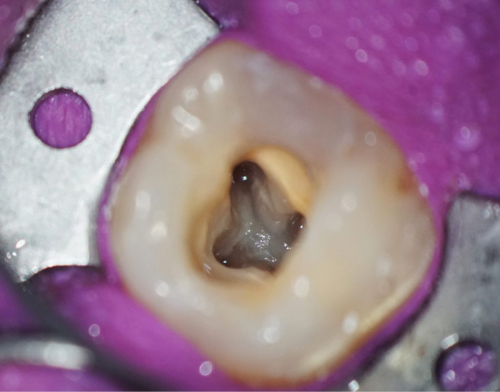 Anatomia systemu kanałowego