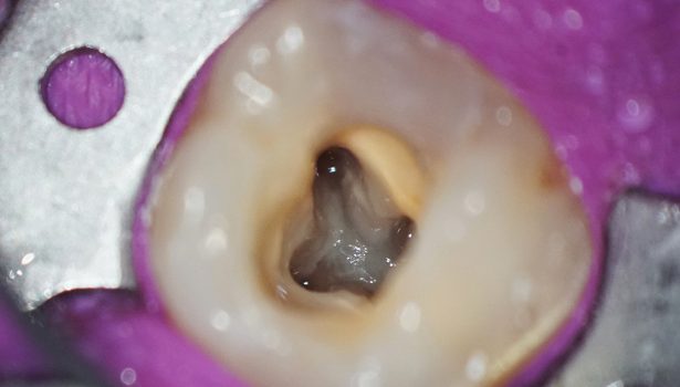 Anatomia systemu kanałowego