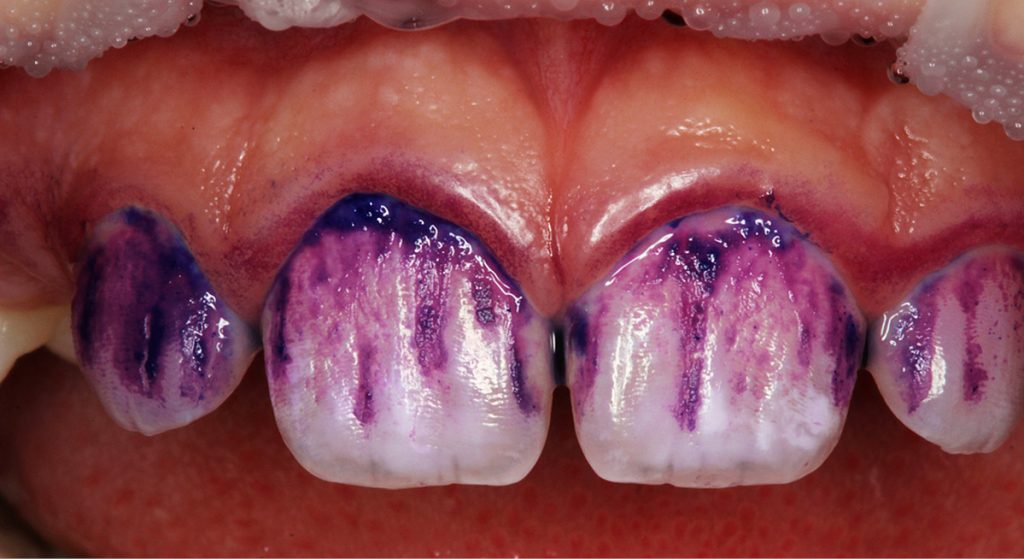 Nowoczesne podejście do profilaktyki