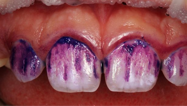 Nowoczesne podejście do profilaktyki