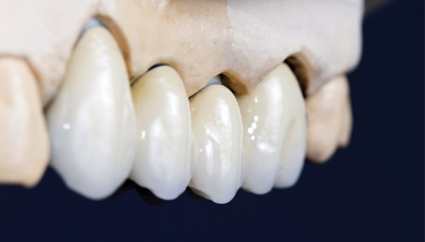 TPS_4_16_sprzet_i_materialy_ANALIZA_CHARAKTERU_I_WYTRZYMALOSCI_POLACZENIA_Thinkstock-177693753