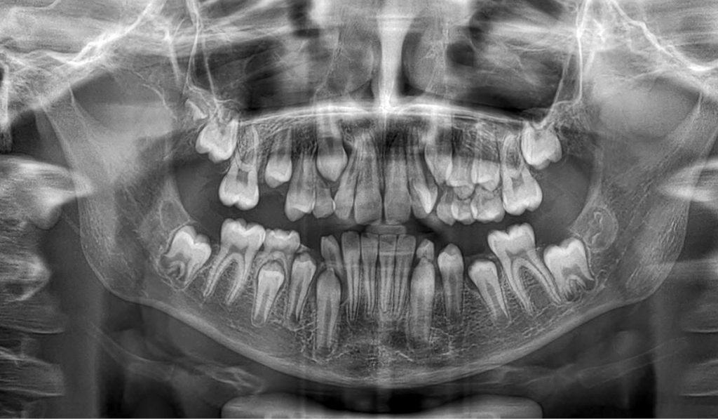 TPS_3-4_21_stomatologia_wieku_rozwojowego_DODATKOWY_KIEL_W_SZCZECE_FOT_2