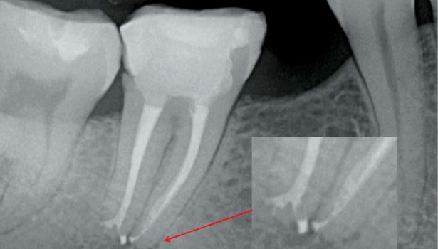EWP_4_14_adam_zawadka_SYSTEM_SELF_ADJUSTING_FILE_RYC_12