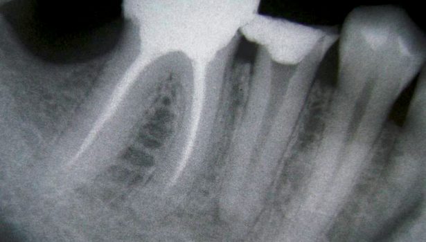 EWP_4_14_slawomir_gabrys_SZEROKIE_WIERZCHOLKI_KANALOW_RYC_1_A