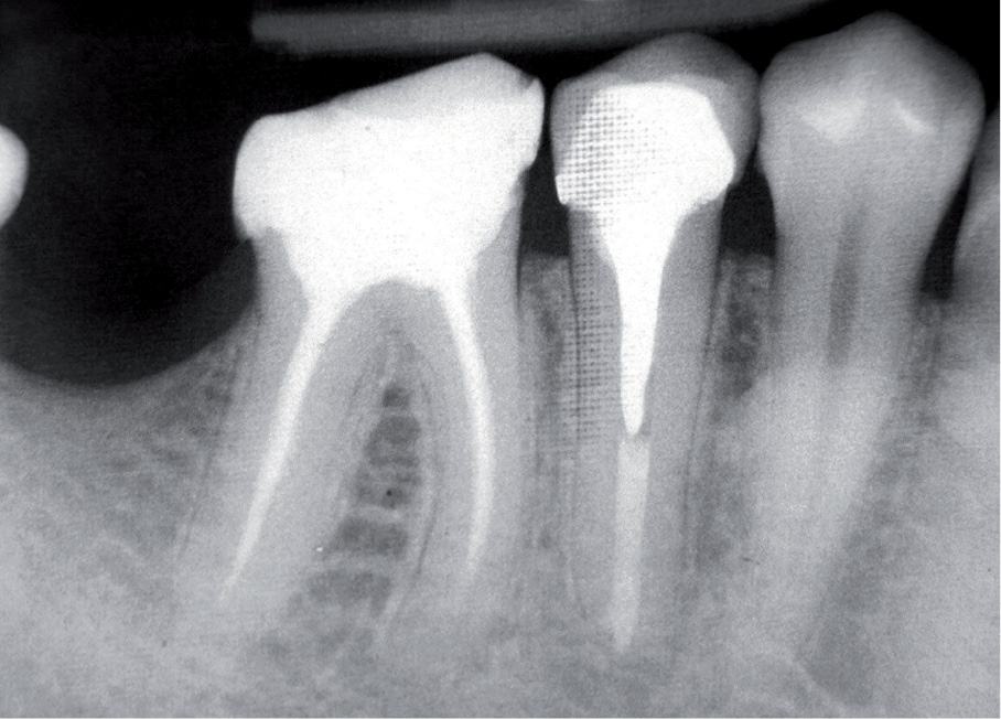 EWP_4_14_slawomir_gabrys_SZEROKIE_WIERZCHOLKI_KANALOW_RYC_1_D