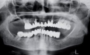 EWP_2_14_KONCOWKA_ULTRADZWIEKOWA_START-X_NR_4_RYC_1