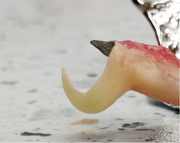 TPS_6_21_sprzet_i_materialy_natalia_debowska_PROTEZY_ALTERNATYWNE_MATERIALY_FOT_5