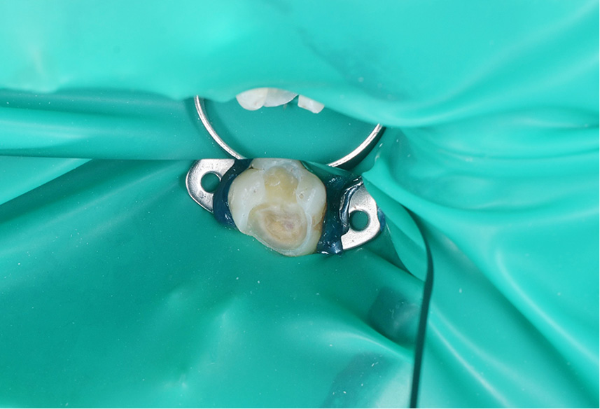 TPS_6_21_sprzet_materialy_ALTERNATYWA_DLA_MATERIALOW_KOMPOZYTOWYCH_FOT_1