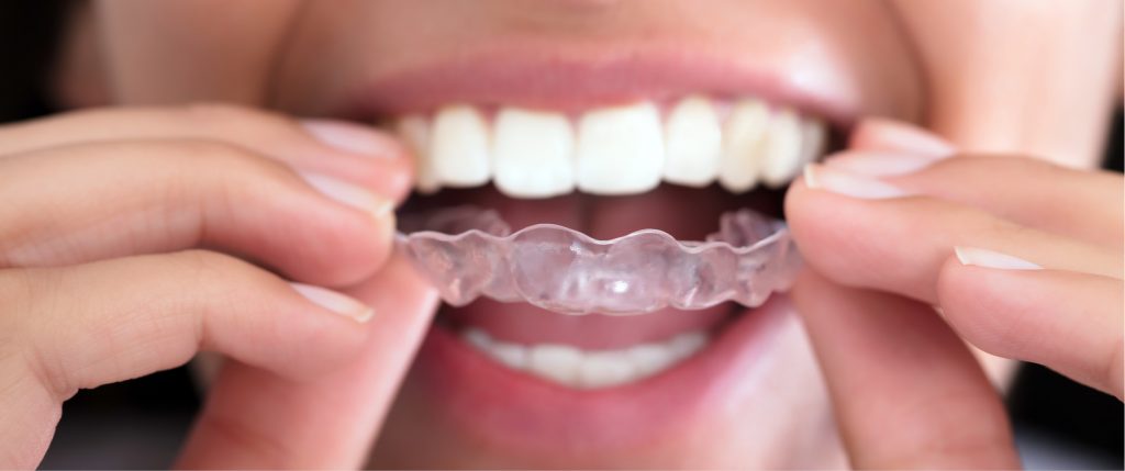 Etiologia i leczenie zaburzeń stawu skroniowo-żuchwowego