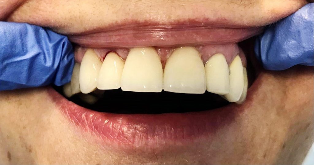 TPS_7-8_21_protetyka_dysfunkcje_narzadu_zucia_marta_jaworska_ESTETYKA_TWARZY_FOT_2