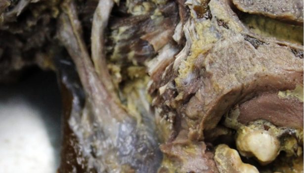 TPS_7-8_21_protetyka_dysfunkcje_narzadu_zucia_ROLA_WIEZADLA_KLINOWO_ZUCHWOWEGO_2