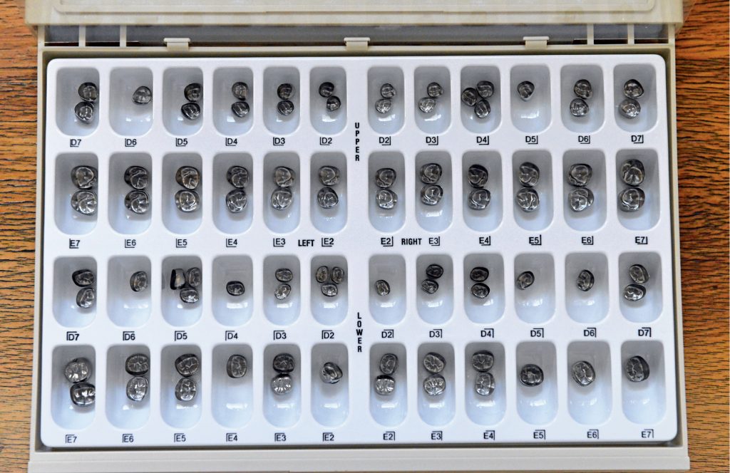 TPS_9_21_sprzet_i_materialy_PREFABRYKOWANE_KORONY_STALOWE_FOT_1