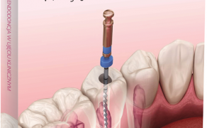 endodoncja w ujęciu klinicznym