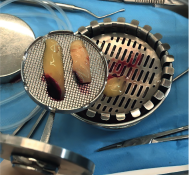 Rola biologicznych czynników wzrostu