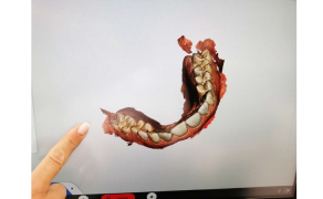 Fot. 11. Prawidłowo zeskanowany górny łuk zębowy