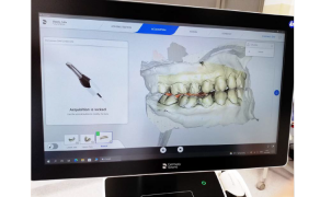 Fot. 12. Zeskanowanie górnej i dolnej części łuku zębowego oraz rejestracja relacji centralnej