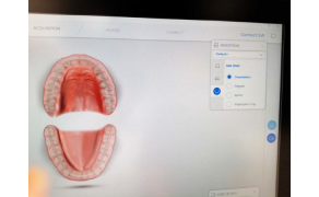 Fot. 5. Wybór wskazania do skanu wewnątrzustnego