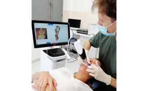 Fot. 7. Przystąpienie do skanowania wewnątrzustnego – tylne części łuku zębowego