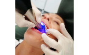 Fot. 9. Skanowanie odcinka przedniego łuku zębowego – powierzchnia podniebienna