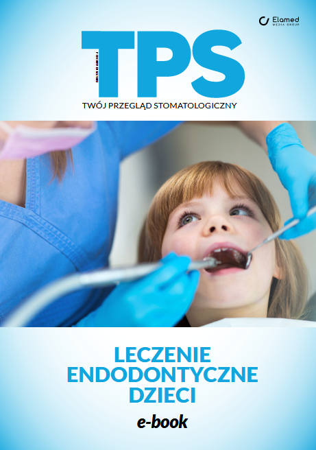 Leczenie endodontyczne dzieci (e-book)