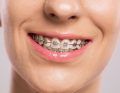 przegląd zagadnień ortodontycznych