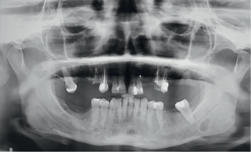 TPS_1-2_22_Klaudia_Klosok_Katarzyna_Luczak_OGRANICZENIA_I_PULAPKI_ZDJEC_RADIOLOGICZNYCH_RYC_17