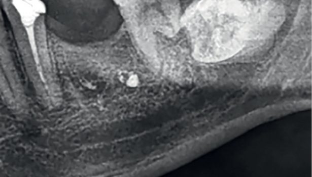 konwencjonalne zdjęcia radiologiczne