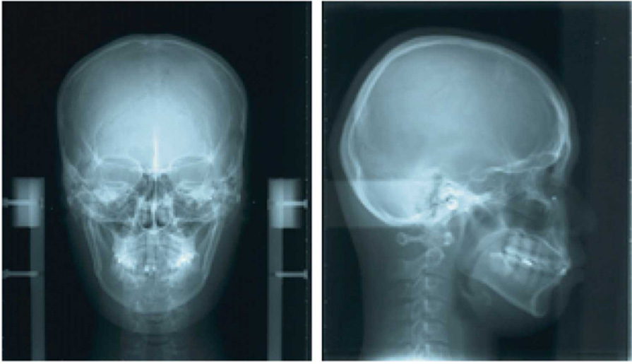 OWP_2_19_PACJENTKA_Z_I_KLASA_ANGLEA_RYC_2_A