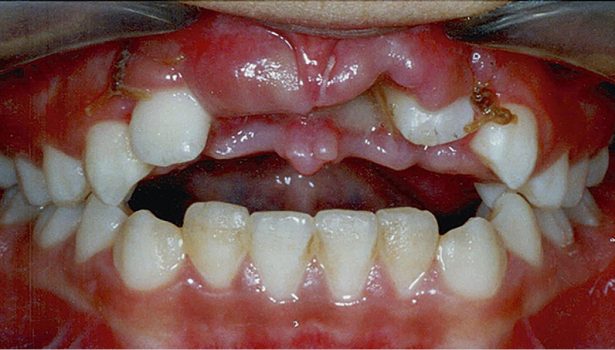 OWP_3_19_URAZ_OKOLICY_ZEBOW_SIECZNYCH_RYC_1