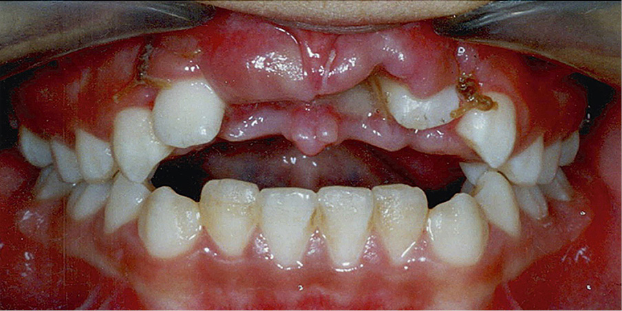 OWP_3_19_URAZ_OKOLICY_ZEBOW_SIECZNYCH_RYC_1