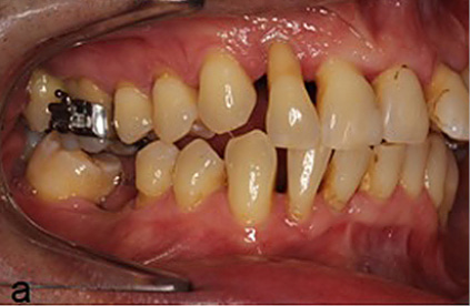OWP_3_19_LECZENIE_PACJENTOW_PERIODONTOLOGICZNYCH_RYC_4_A