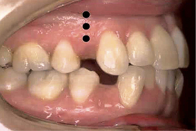 OWP_3_19_MINISRUBY_ORTODONTYCZNE_RYC_1