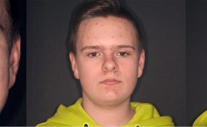 OWP_3_19_LECZENIE_PACJENTA_ROSNACEGO_Z_II_KLASA_SZKIELETOWA_FOT_6