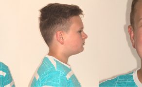 OWP_3_19_LECZENIE_PACJENTA_ROSNACEGO_Z_II_KLASA_SZKIELETOWA_FOT_8