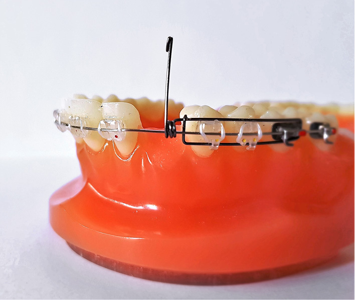 OWP_4_19_SPREZYNA_DO_SPROWADZANIA_ZATRZYMANYCH_KLOW_RYC_2